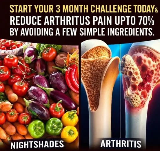 Arthritis.